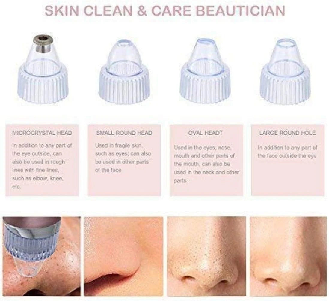 Pore Cleaning Device – Clear Skin, No Filters Needed!
