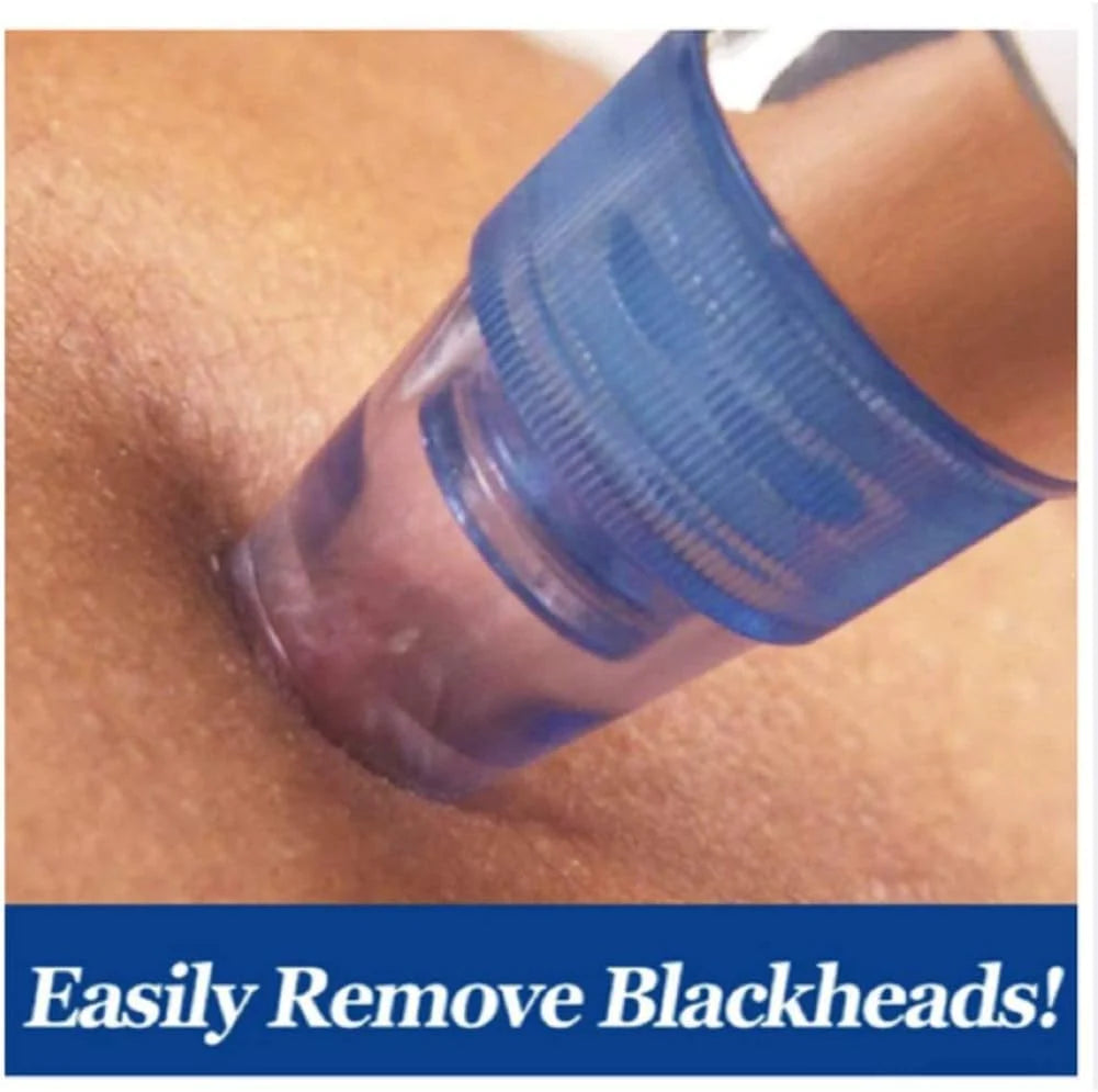 Pore Cleaning Device – Clear Skin, No Filters Needed!